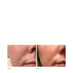 Dr Dennis Gross DRx Acne Eliminating Gel 11 Dr Dennis Gross DRx Acne Eliminating Gel -Care Product Store DRx Acne Eliminating Gel add5 65307 6090 general